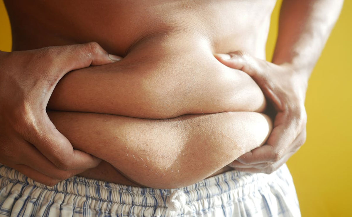 Čo je obezita a ako ju definovať